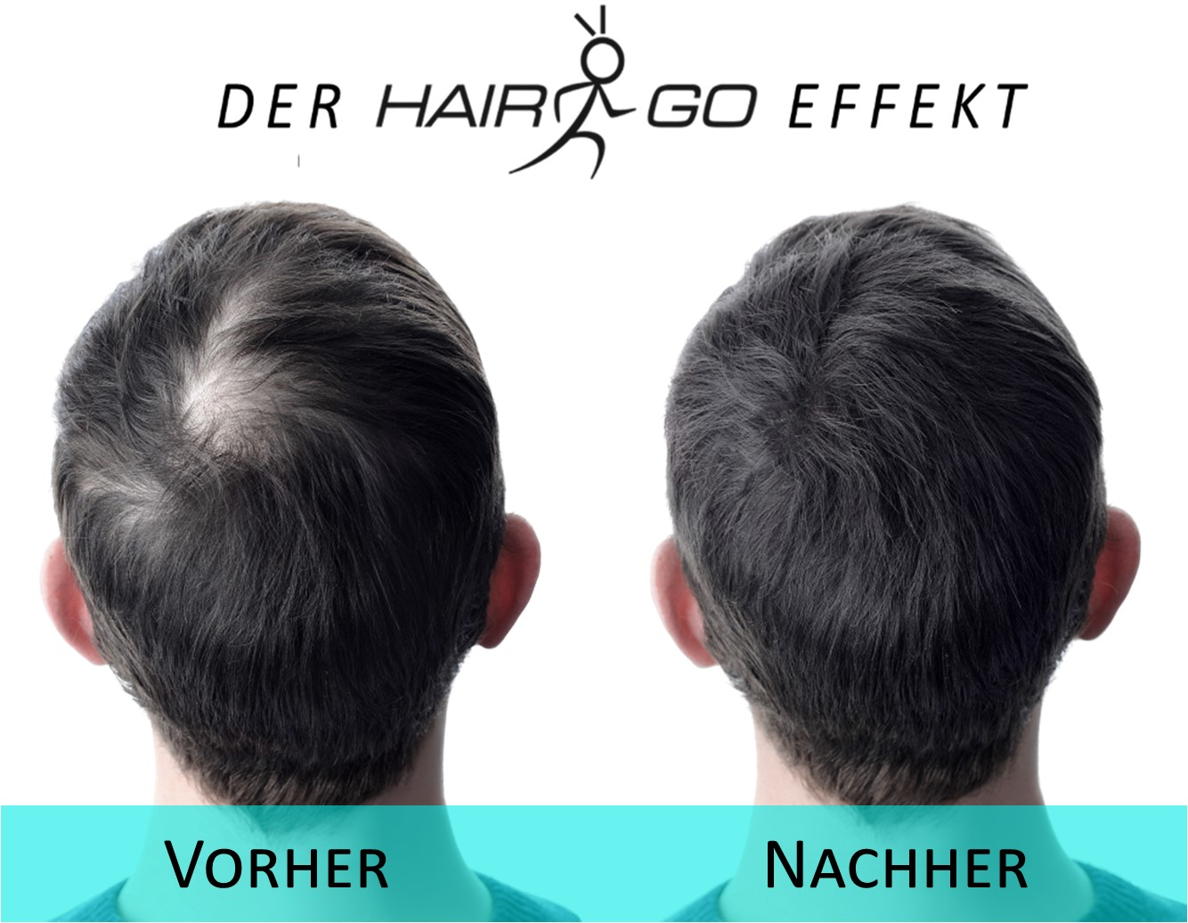 HairGo Vorher-Nachher Schwarz